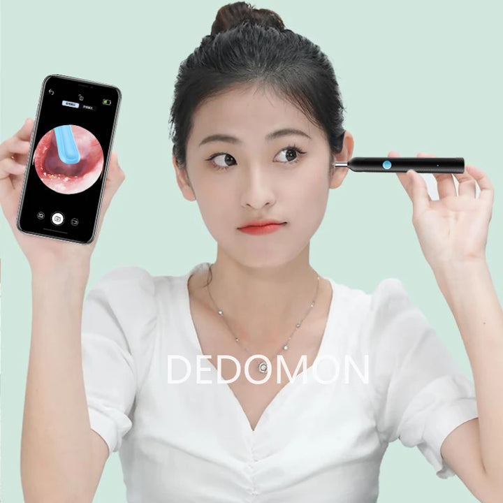 أداة إزالة الشمع VisionEar™