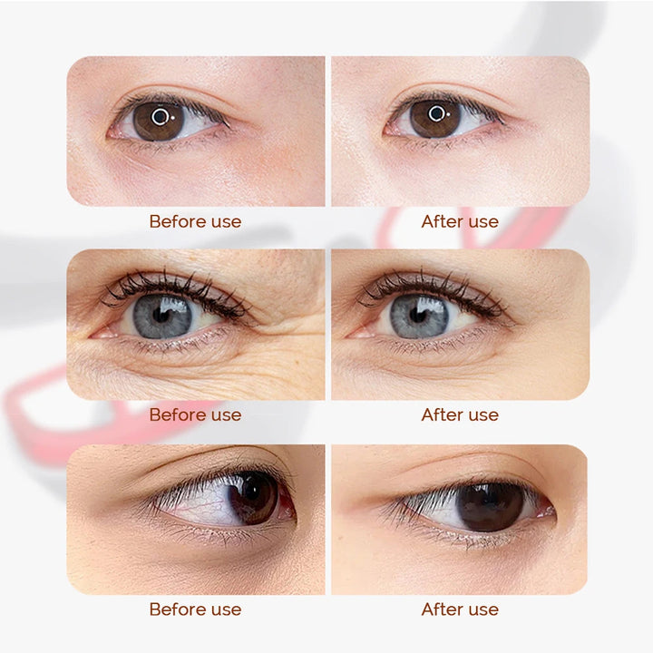 VisionEase™ Wireless Eye Massager